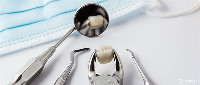 Arrancar dentes: oiça o seu Médico Dentista e siga as suas recomendações.