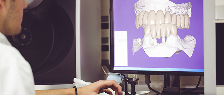 A tecnologia CAD/CAM facilita muitos tratamentos dentários.