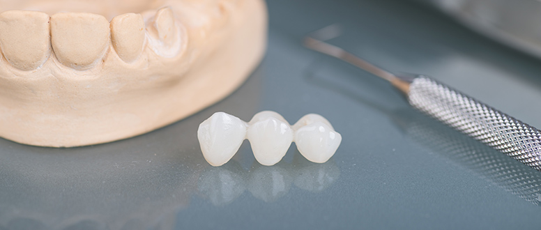 As restaurações indiretas permitem reparar a estrutura de dentes danificados.