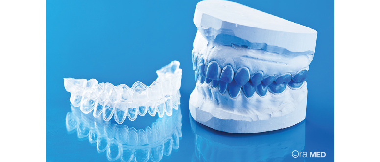 branqueamento dentário em casa ambulatório