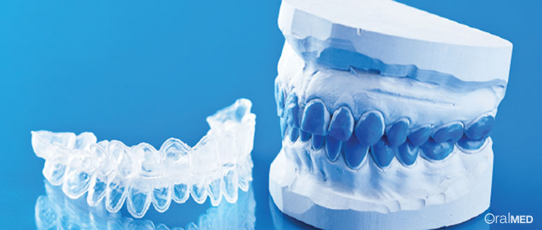As goteiras são fundamentais ao branqueamento dentario em casa.