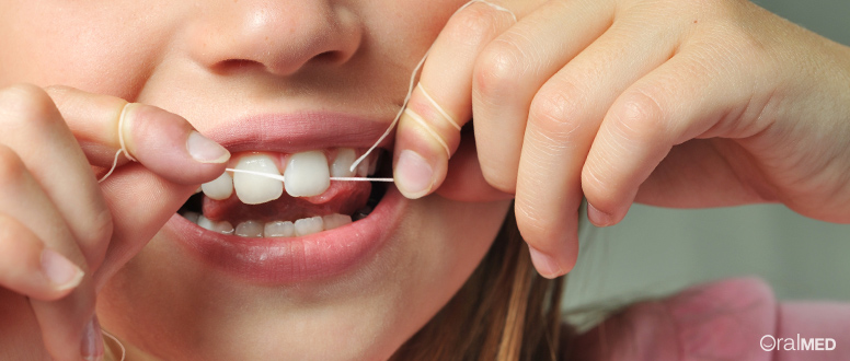 Os dentes de leite devem receber tantos cuidados quanto os definitivos.