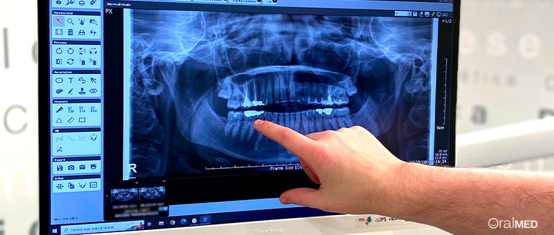 Imagem de uma ortopantomografia: uma ferramenta de diagnóstico usada por dentistas