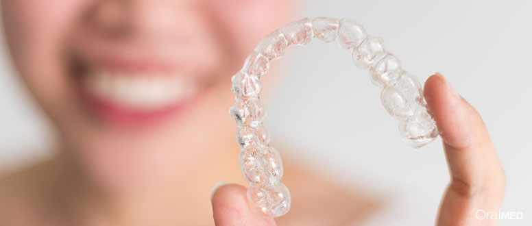 Esclareça os mitos sobre o Invisalign.