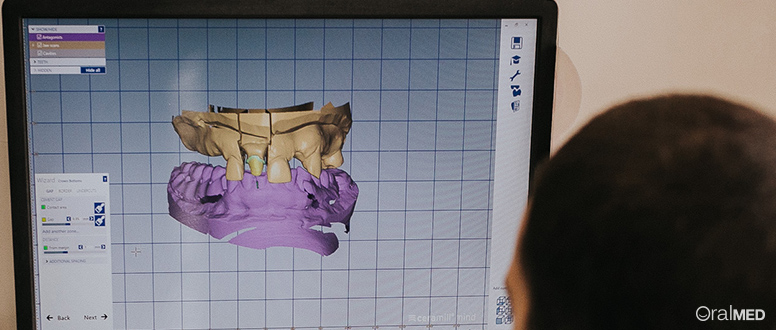 Exemplo da modelação de um trabalho em 3D, por um técnico especializado em CAD/CAM.