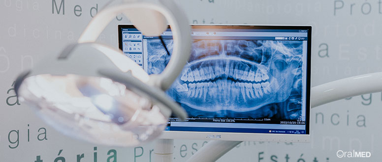A clinica dentaria OralMED Queluz dispõe de meios de diagnóstico como a ortopantomografia.