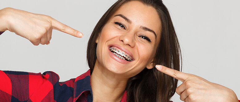 Aparelho dentário: Conheça os 7 principais tipos