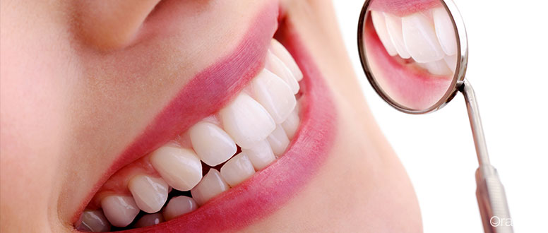 Restauraçao dentaria: materiais e processos diferentes oferecem resultados diferentes.