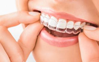 O aparelho invisível traz inúmeras vantagens para os Pacientes.