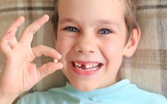 Os dentes de leite exigem tantos cuidados quanto os permanentes.