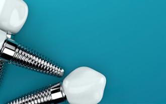 A biocompatibilidade do titânio foi descoberta nos anos 50.