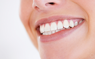  Branqueamento dentário: tudo explicado ao detalhe