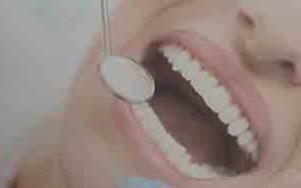 Dentes: 10 factos que tem de conhecer!