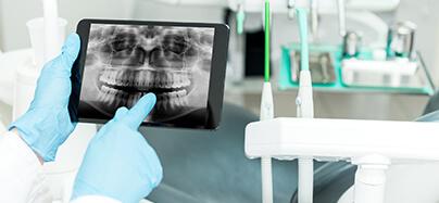 O Digital Smile Design ajuda a criar soluções estéticas personalizadas.