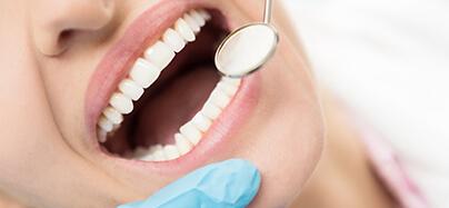 Dentes estragados