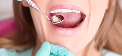 restaurações dentárias