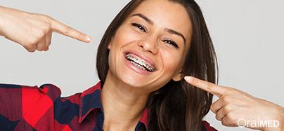 Elásticos no aparelho dentário: é preciso ter elásticos coloridos?
