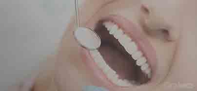 Dentes: 10 factos que tem de conhecer!